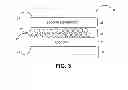 Fig. 04 - Tissue grafts composed of micronized placental tissue and methods of making and using the same