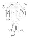 Fig. 07 - Pressure and acceleration based pedestrian impact sensor assembly for motor vehicles