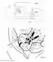Fig. 02 - WARNING SYSTEM FOR DETECTING INFANT SEAT BUCKLE SECUREMENT