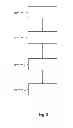 Fig. 04 - Assistance system for a motor vehicle and method for controlling a motor vehicle