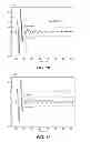 Fig. 08 - Method for Cement Evaluation with Acoustic and Nuclear Density Logs