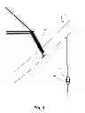 Fig. 04 - Wire timing and tensioning device