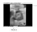 Fig. 12 - Method and Apparatus for Sequentially Displaying a Plurality of Images Including Selective Asynchronous Matching of a Subset of the Images