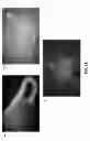 Fig. 13 - Highly Active Soybean Promoters and Uses Thereof