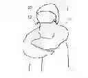 Fig. 01 - Face Shield Attachment for Winter Jacket Hoods
