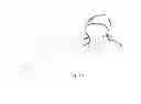 Fig. 07 - Face Shield Attachment for Winter Jacket Hoods