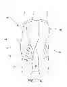Fig. 02 - Garment with adjustable lacing arrangement
