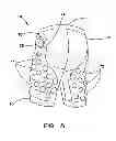 Fig. 08 - Garment with adjustable lacing arrangement