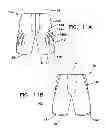 Fig. 17 - Garment with adjustable lacing arrangement
