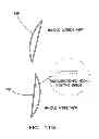 Fig. 19 - Garment with adjustable lacing arrangement