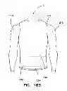 Fig. 31 - Garment with adjustable lacing arrangement