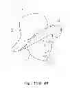 Fig. 03 - SUN HAT