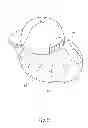 Fig. 06 - SUN HAT