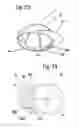 Fig. 18 - POWER HEADGEAR