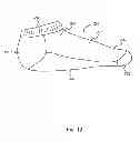 Fig. 13 - GARMENT INCLUDING CUSHION AND METHOD OF MAKING SAME