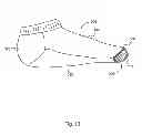 Fig. 14 - GARMENT INCLUDING CUSHION AND METHOD OF MAKING SAME