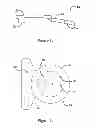 Fig. 03 - Belt buckle