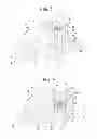 Fig. 03 - Catheter tip cutting tool