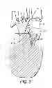 Fig. 04 - ORTHOTIC INSOLE