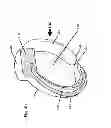 Fig. 09 - ADJUSTABLE RING