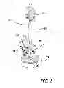 Fig. 03 - Endosseous dental implant loading fixture