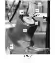 Fig. 04 - Endosseous dental implant loading fixture