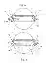 Fig. 04 - Magnetic-inductive flow meter and method for its production