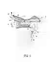 Fig. 04 - Bicycle control device