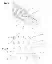 Fig. 05 - Orthopedic fastener method