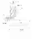 Fig. 08 - Orthopedic fastener method