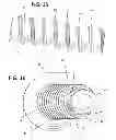 Fig. 09 - Orthopedic fastener method