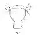 Fig. 08 - MUSICAL INSTRUMENT HEAD MOUNTING DEVICE