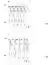 Fig. 05 - Electro-mechanically assisted bass drum pedal and method of use
