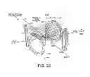 Fig. 15 - Generating a homogeneous magnetic field while pulling a single crystal from molten semiconductor material