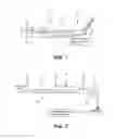 Fig. 02 - Method and device for non-invasive anatomical and systemic cooling and neuroprotection