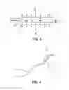 Fig. 04 - Method and device for non-invasive anatomical and systemic cooling and neuroprotection