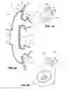Fig. 10 - Patient interface systems