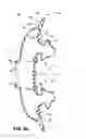 Fig. 13 - Patient interface systems