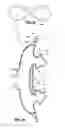 Fig. 17 - Patient interface systems