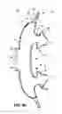 Fig. 19 - Patient interface systems