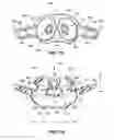 Fig. 30 - Patient interface systems