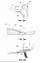 Fig. 37 - Patient interface systems