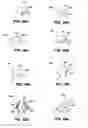Fig. 80 - Patient interface systems