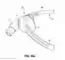 Fig. 87 - Patient interface systems