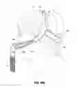 Fig. 94 - Patient interface systems