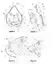 Fig. 02 - Respiratory mask