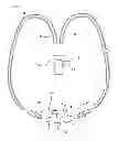 Fig. 01 - VENTILATION INTERFACE FOR SLEEP APNEA THERAPY