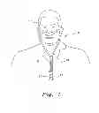 Fig. 02 - VENTILATION INTERFACE FOR SLEEP APNEA THERAPY