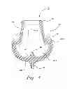 Fig. 06 - VENTILATION INTERFACE FOR SLEEP APNEA THERAPY