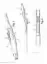 Fig. 02 - LINEAR MOTION DELIVERY SYSTEM FOR FEMALE STERILIZATION DEVICE